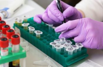 Всплеск на морбилите в България: 153 потвърдени случая и тревожна статистика за ваксинацията